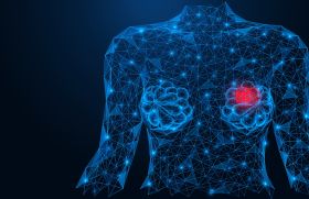Pembrolizumab en néoadjuvant et cancers du sein triple négatifs localisés - 