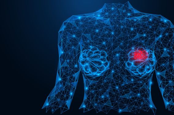 Pembrolizumab en néoadjuvant et cancers du sein triple négatifs localisés - 