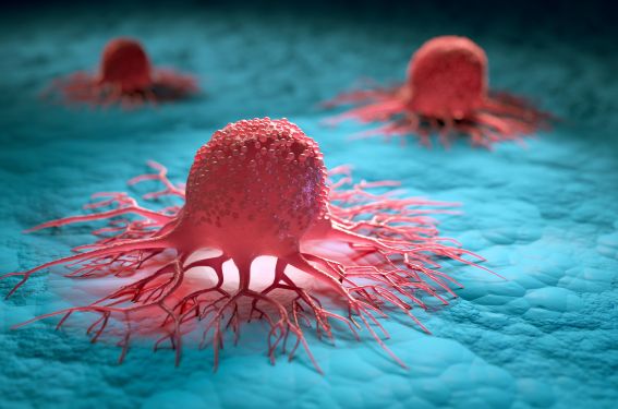 Immunothérapie et chimio-embolisation dans le CHC